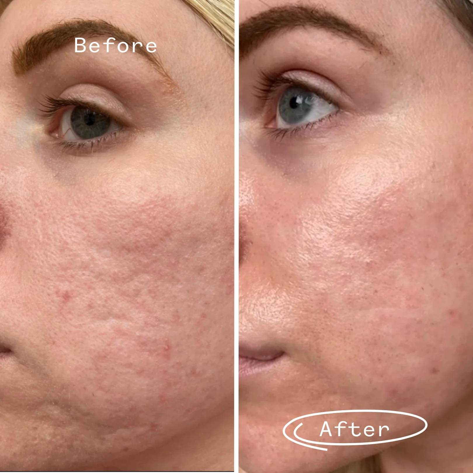 Hyaluronic Acid 0.3% Hydrating Booster - Image 4