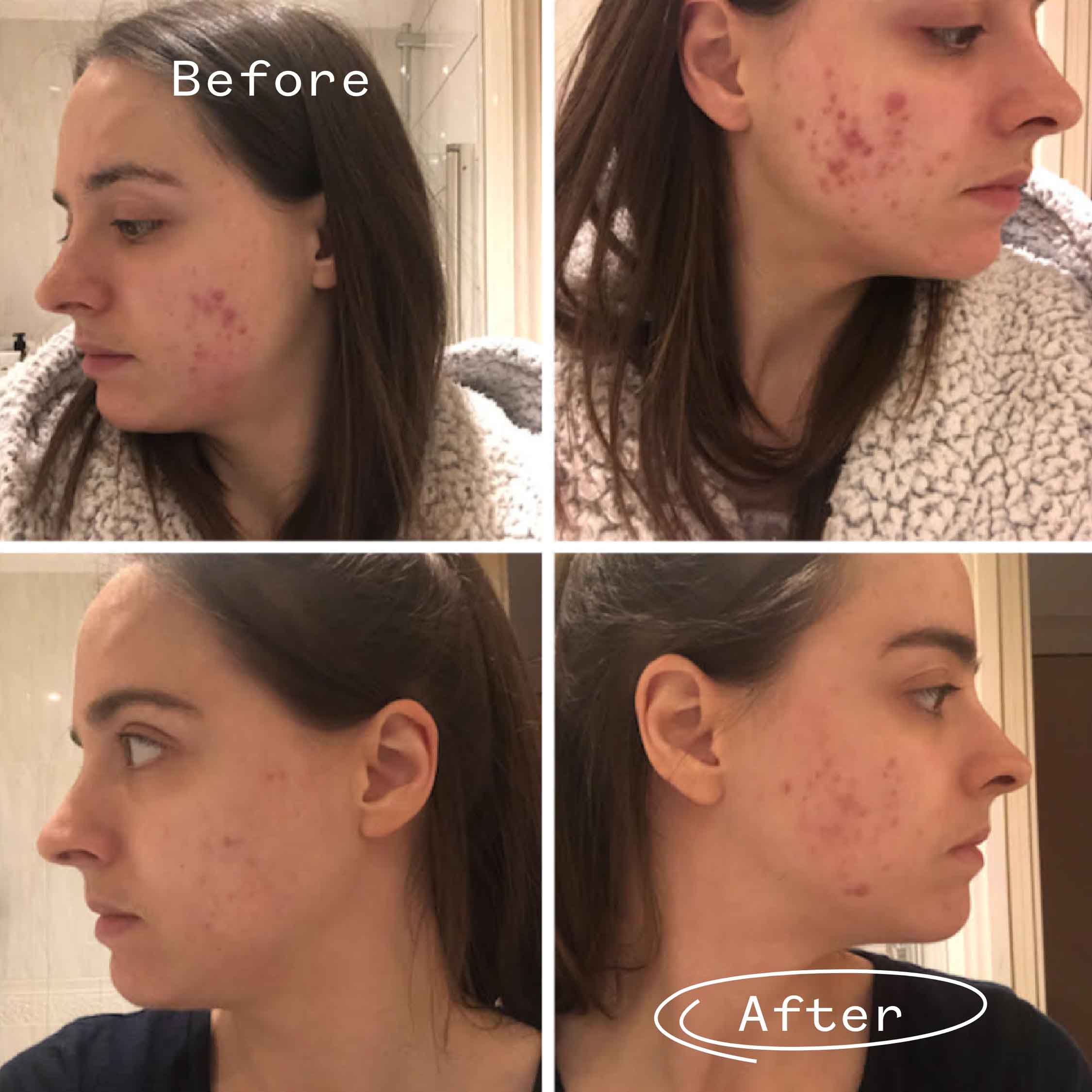 Instant Kalmer™ Serum - Image 4