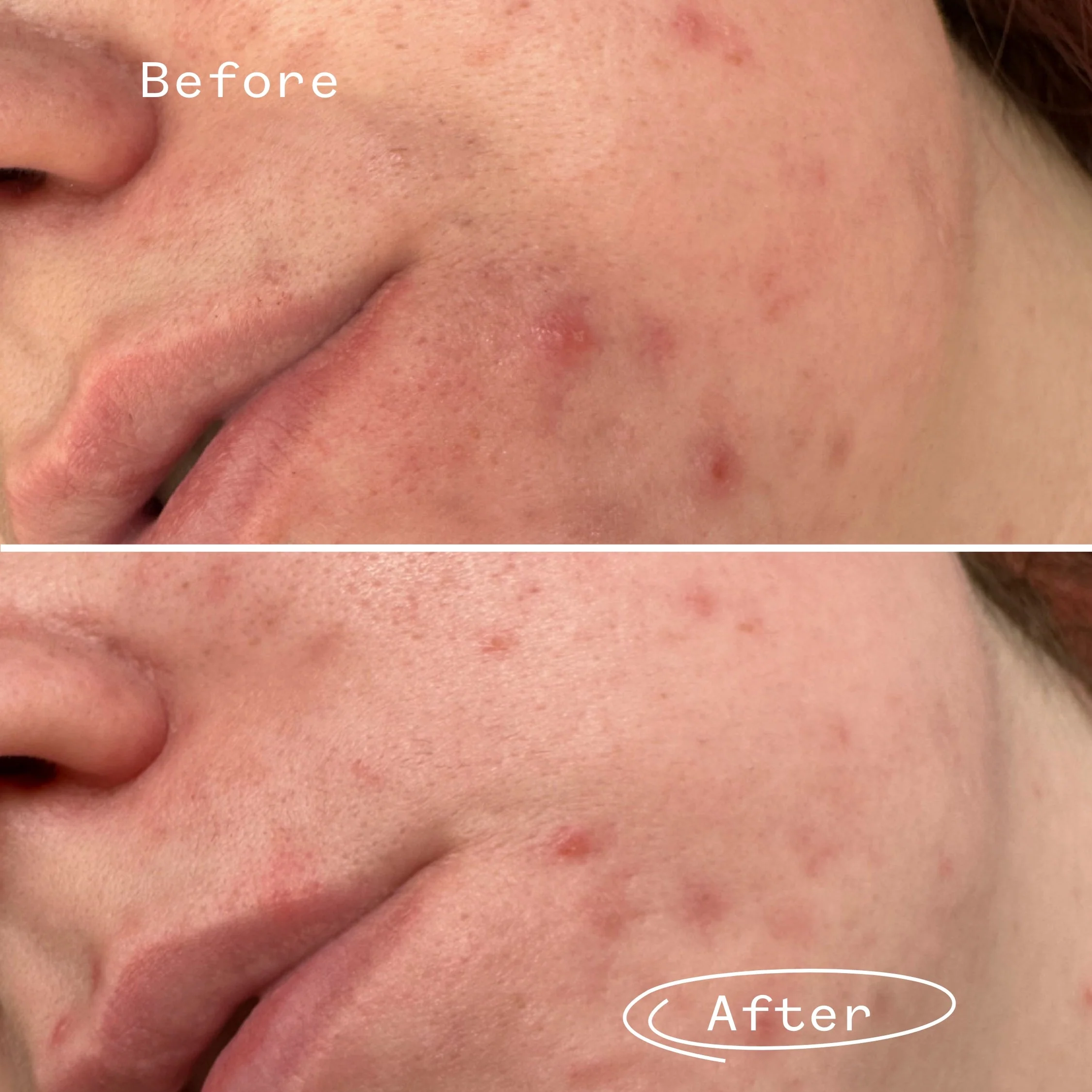 Phaze™ Gel Cleanser - Image 4