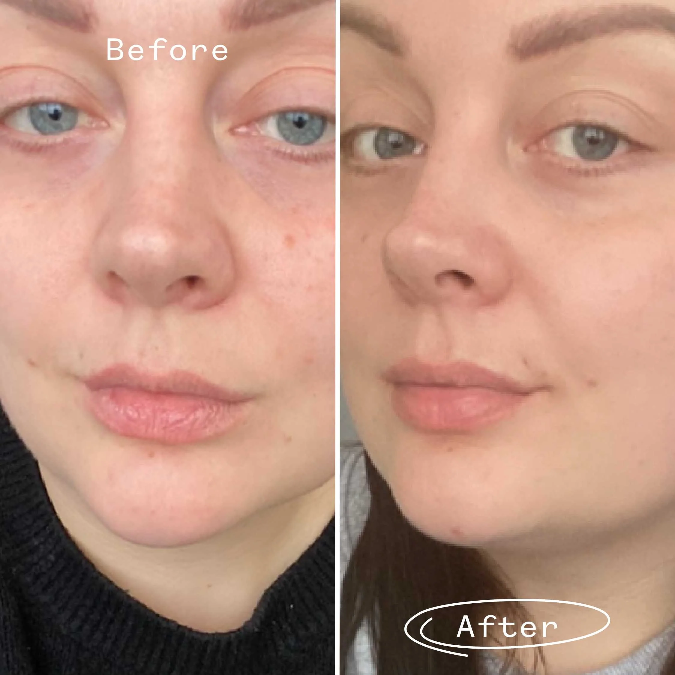 Rosehip Bioregenerate™ Face Oil - Image 4